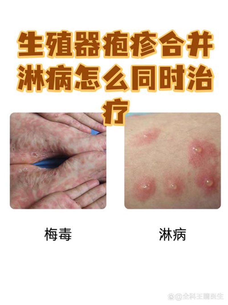 生殖健康
